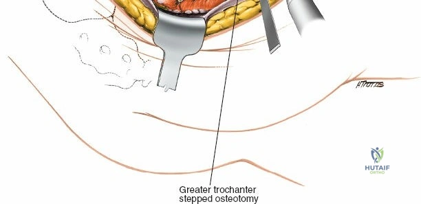 Clinical Image