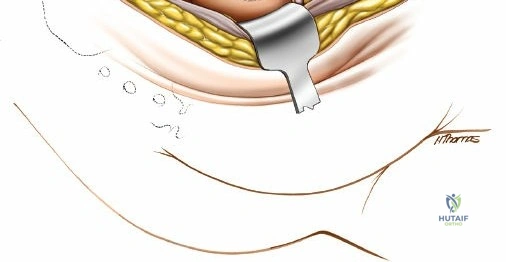 Clinical Image