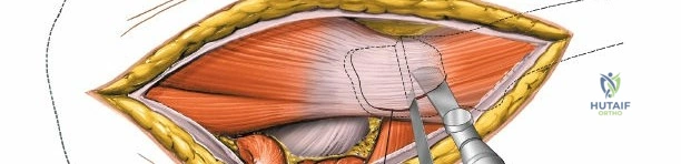 Clinical Image