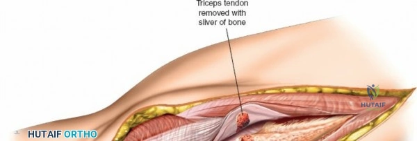 Clinical Image