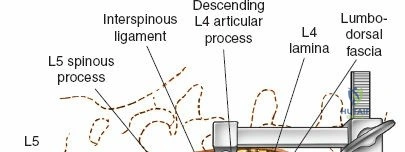 Clinical Image