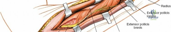 Clinical Image