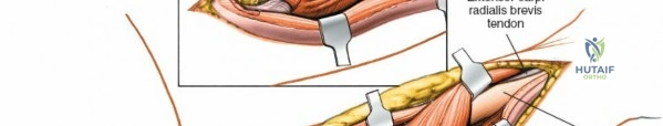 Clinical Image