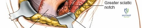 Clinical Image