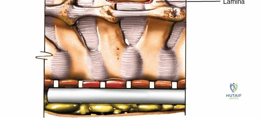 Illustration of subaxial cervical spine - Dr. Mohammed Hutaif