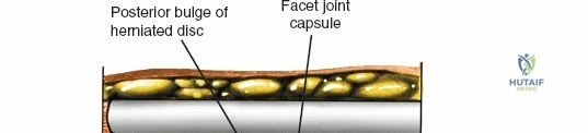 Clinical Image