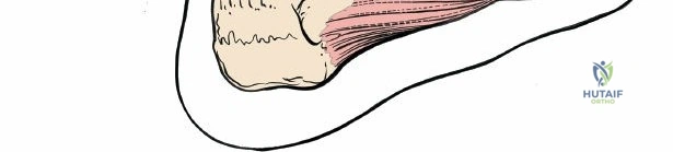 Illustration of hallucis longus muscle - Dr. Mohammed Hutaif