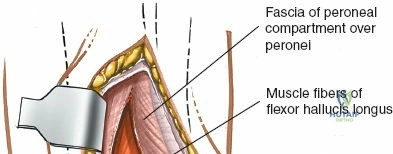 Clinical Image