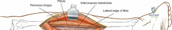 Clinical Image