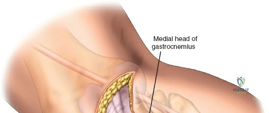 Clinical Image