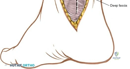 Clinical Image