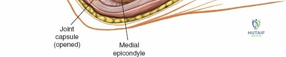 Clinical Image