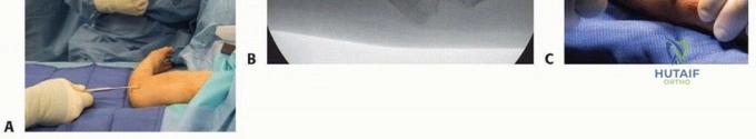 Masterclass in Fundamental Orthopaedic Surgical Techniques and Approaches