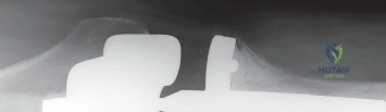 وصف طبي دقيق للمريض