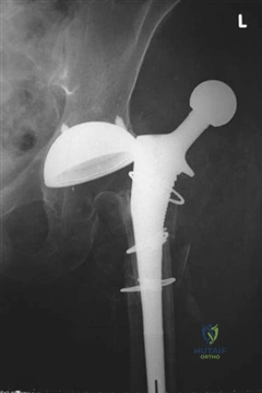 Illustration 17 for Ace FRCS Orthopaedics: Oxford University Press Adult Pathology Viva