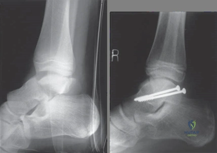 Illustration 2 for Ace Your FRCS: Key Questions in Trauma & Orthopaedics