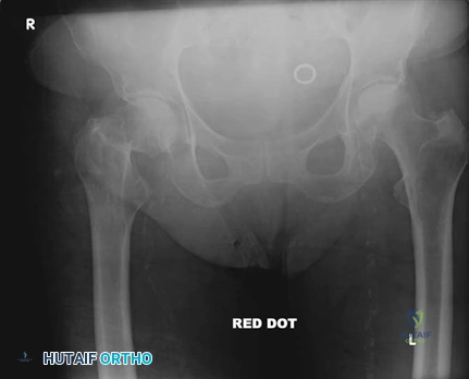Illustration 5 for Ace Your FRCS: Key Questions in Trauma & Orthopaedics