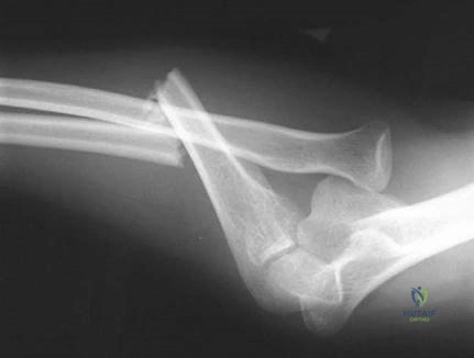 Illustration 16 for Ace Your FRCS: Key Questions in Trauma & Orthopaedics