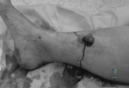 Illustration 1 for Ace Your FRCS: Key Questions in Trauma & Orthopaedics