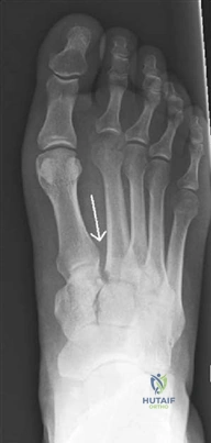 Illustration 3 for Ace Your FRCS: Key Questions in Trauma & Orthopaedics