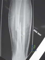 Illustration 10 for Ace Your FRCS: Key Questions in Trauma & Orthopaedics