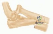 Comprehensive Surgical Management of Carpal Tunnel Syndrome: An Evidence-Based Masterclass
