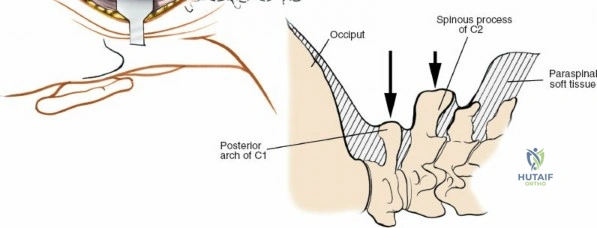 Comprehensive Orthopedic Review | Dr Hutaif General Ort -...