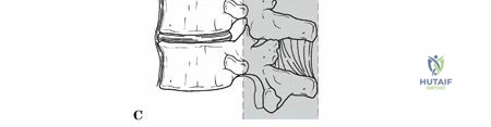 Axial view illustrating spinal columns