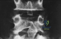 Clinical Image