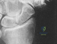 Clinical Image