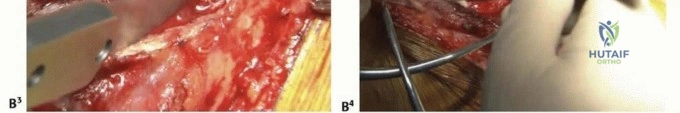 Clinical Image
