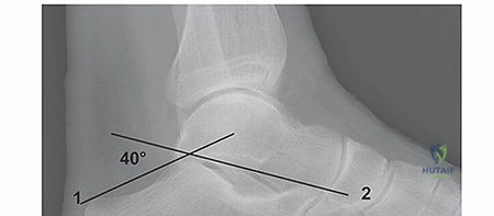 Clinical Image