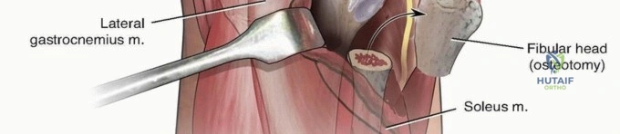 Clinical Image