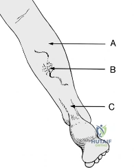 Clinical Image
