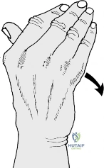 Clinical Image
