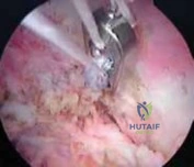 Clinical Image