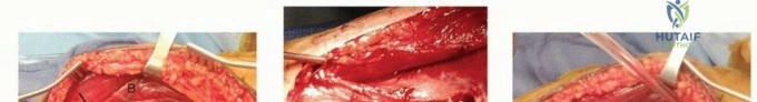 Clinical Image