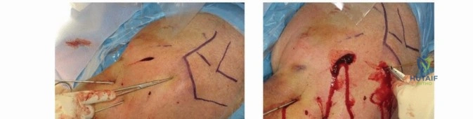Clinical Image