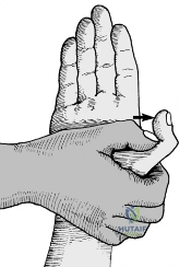 Clinical Image