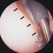 Clinical Image