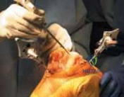 Clinical Image