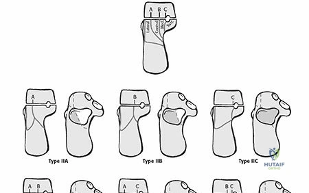 Clinical Image