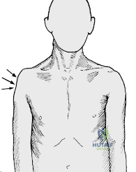 Clinical Image