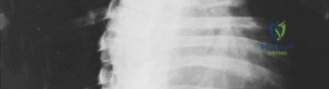 Clinical Image