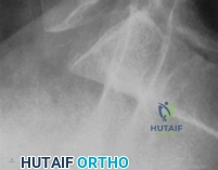 Clinical Image