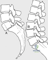 Clinical Image