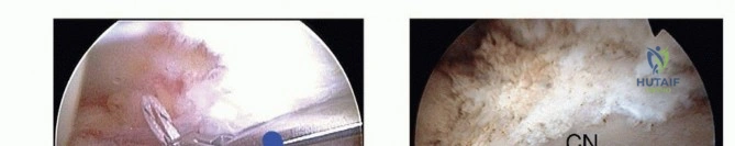 Clinical Image