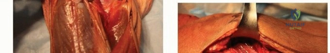Clinical Image