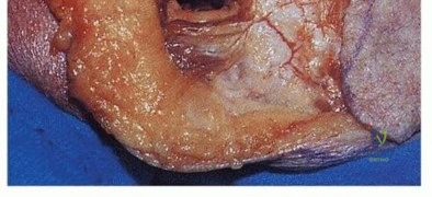 Clinical Image