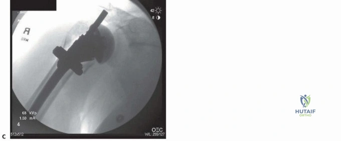 Clinical Image